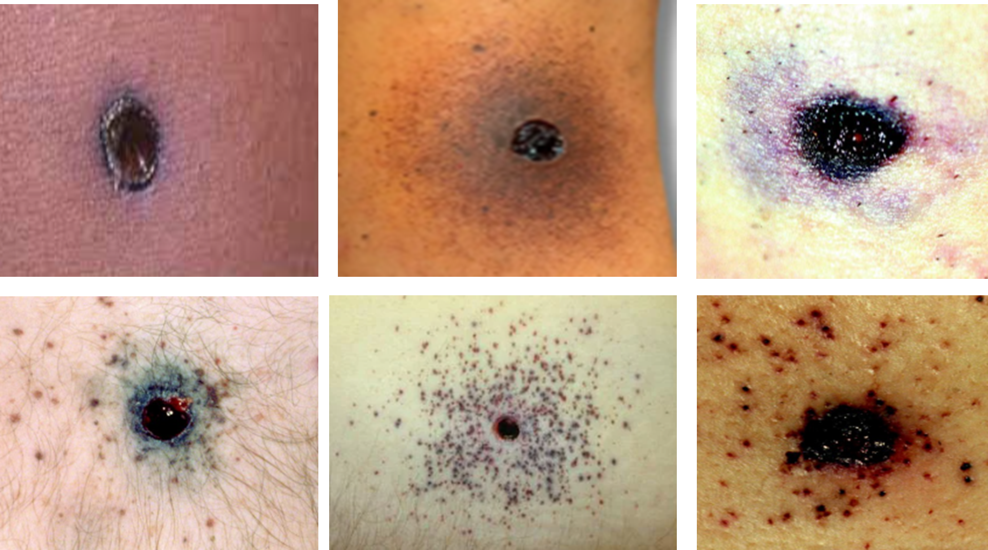 Fig (2) Representative images showing gunshot injuries