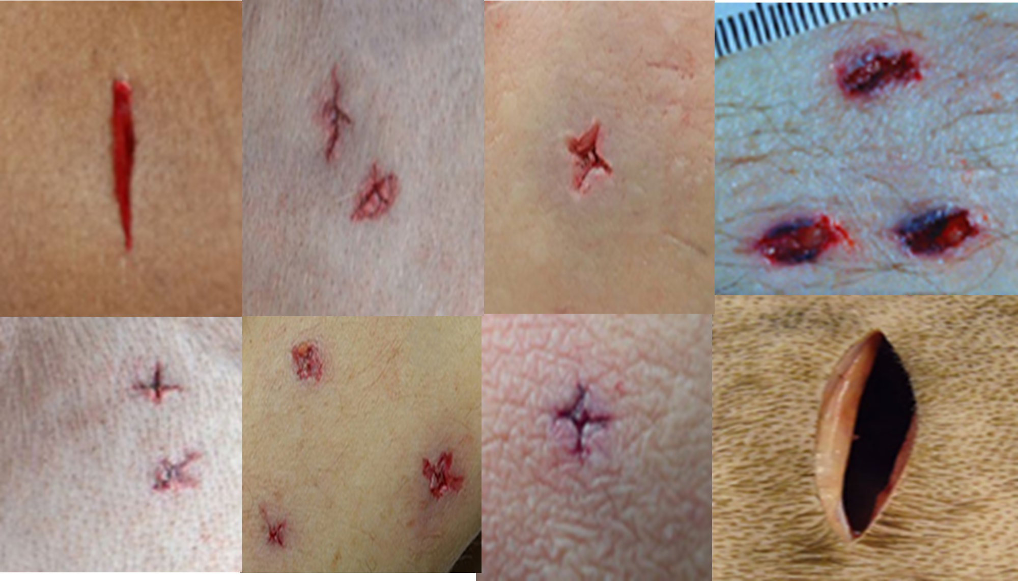 Fig (3) Examples of sharp force injuries
