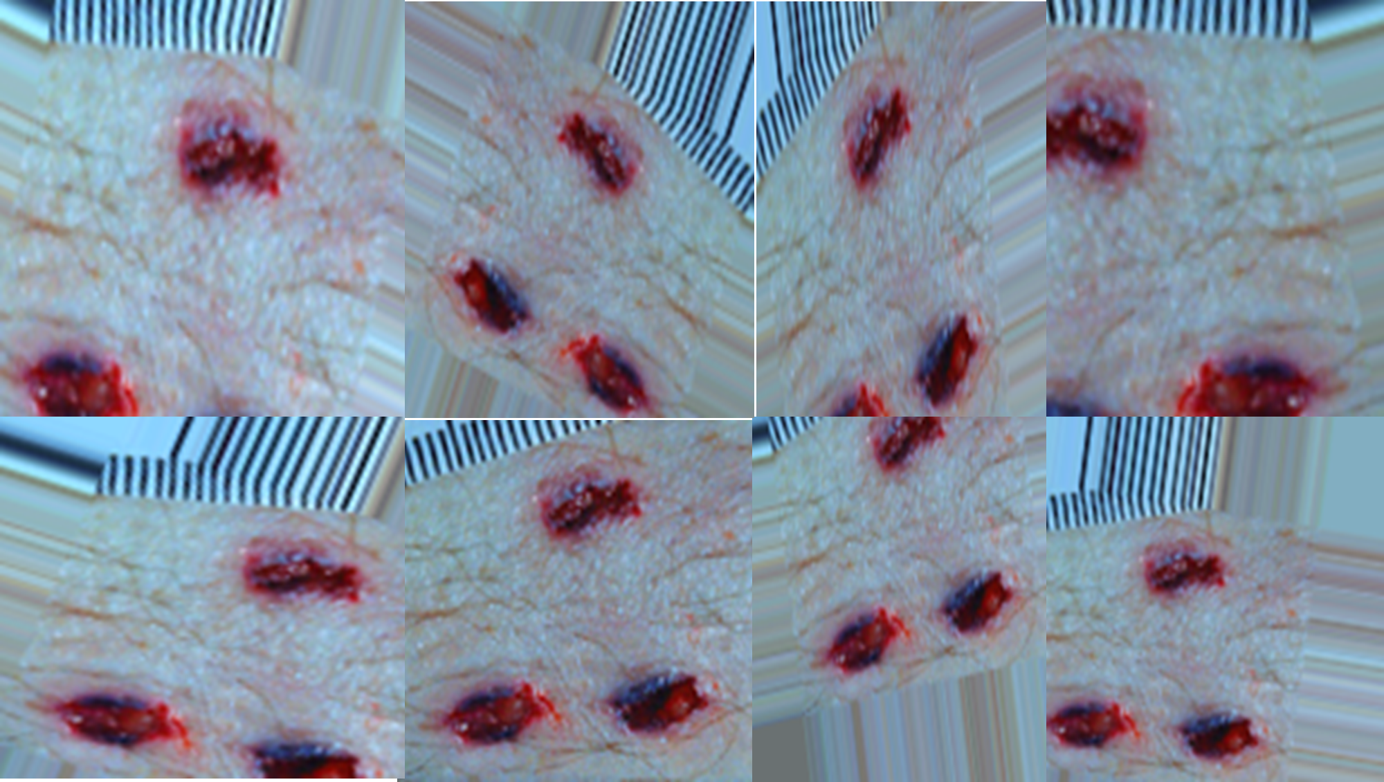 Fig (6) Augmented images of sharp force injuries